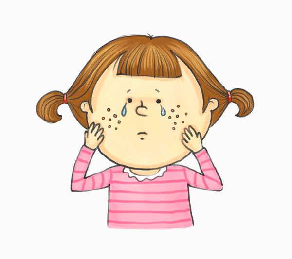 麻疹的出疹顺序 如何预防与饮食 麻疹的出疹顺序 如何预防与饮食