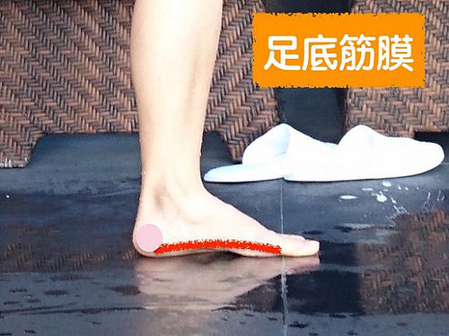 足底筋膜炎可以***吗 小腿_底***法 足底筋膜炎可以***吗 小腿_底***法