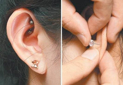 打完耳洞发炎怎么办-打了耳洞发炎快速处理方法4