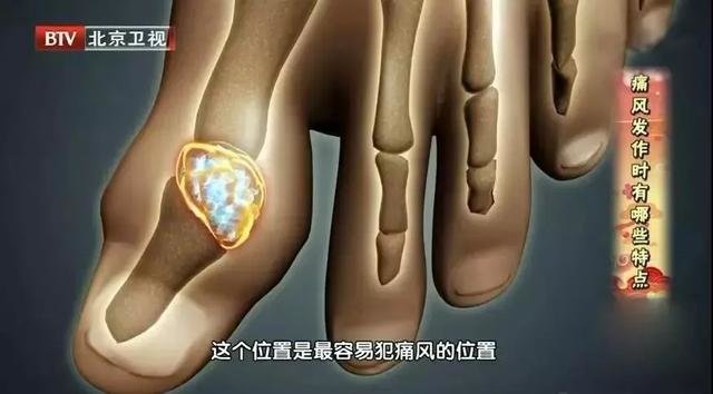 人过50岁，这4种肉一定要少吃！容易致三高8