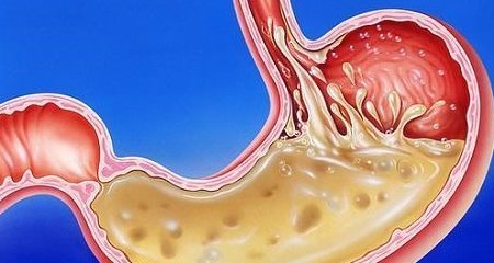 寒冷冬季，老胃病反复发作怎么调理？1