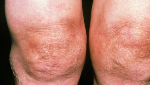 推荐一道食疗【生姜炖鸡】，营养关节，强筋骨，老了腿脚还利索1