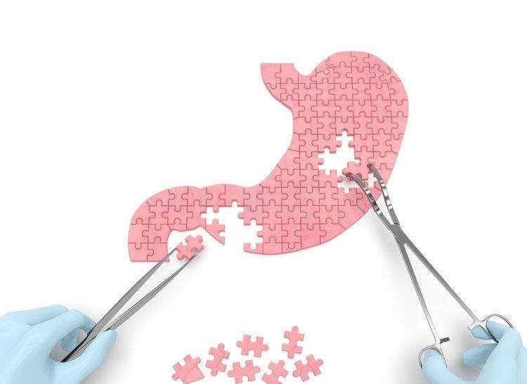 胃养好，人长寿！中医这3大养胃方，会养生的人都在偷偷学3