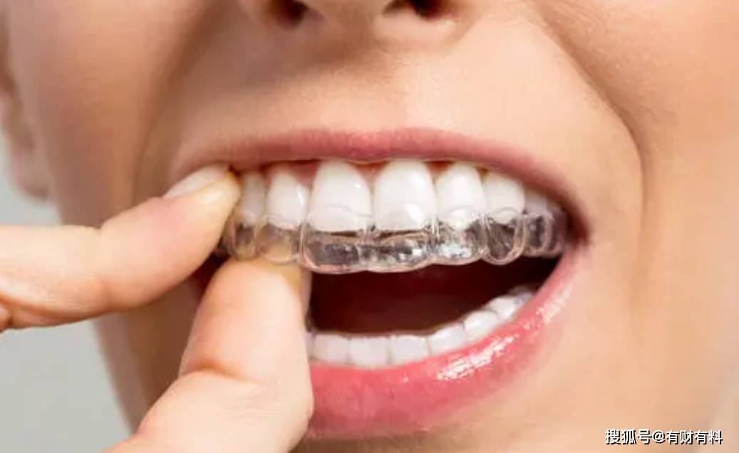 原创 进价1万卖5万，行业毛利率达到70%以上，有厂商一年能赚8亿多6