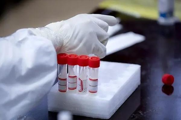 2022低风险地区返乡需要核酸检测吗 具体是哪些地区2